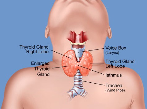 Thyroid Disease: Types, Symptoms, Causes, Diagnosis, and Treatment