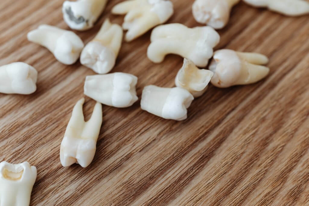 Tooth Loss and Available Solutions